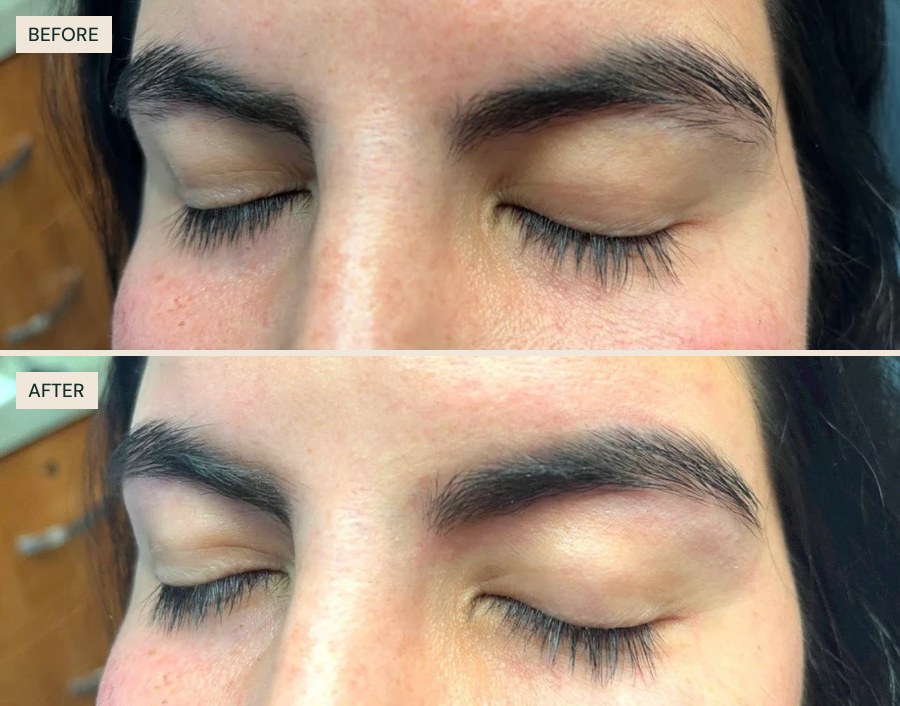 Before and after: brows