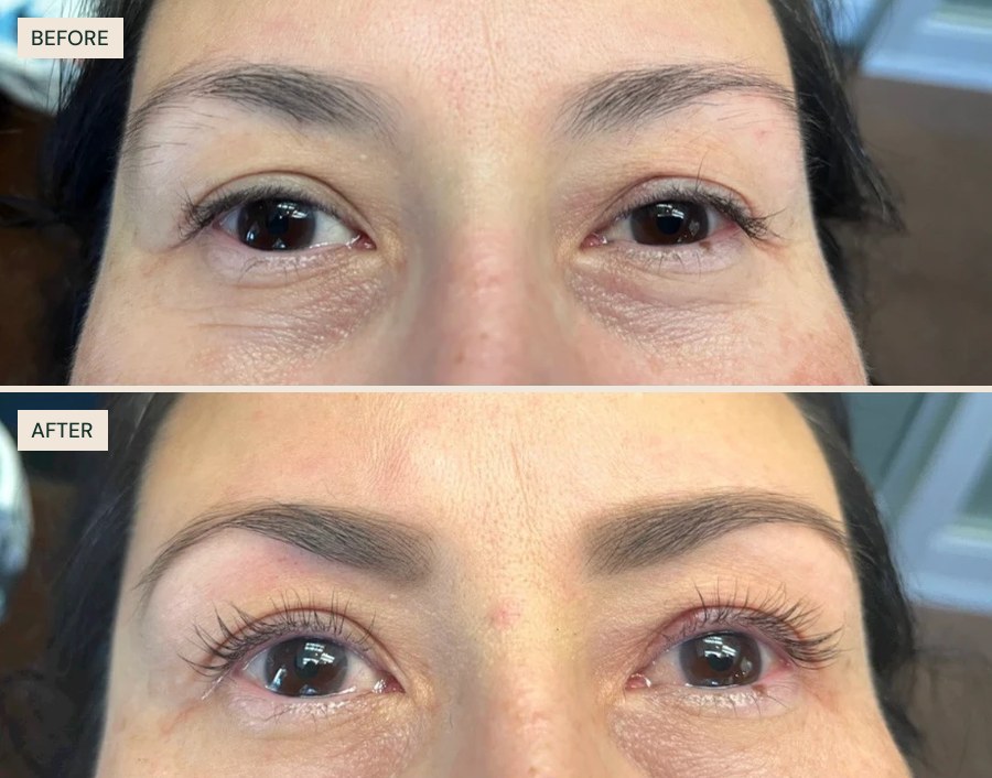 Before and after: brows and lash lift